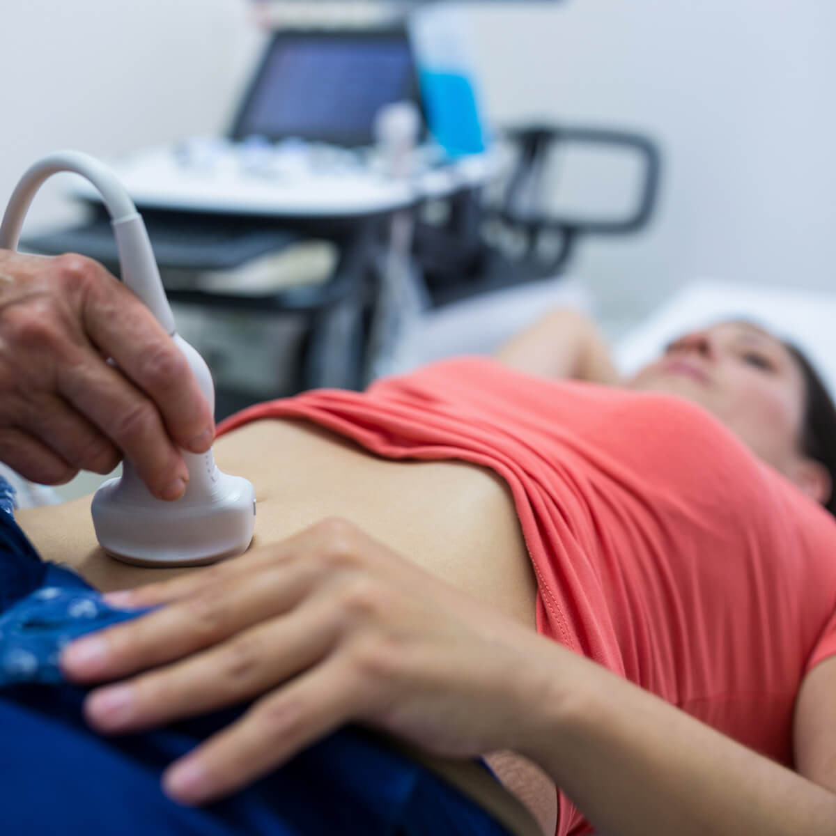 Ultrassom de Fertilidade em João Monlevade