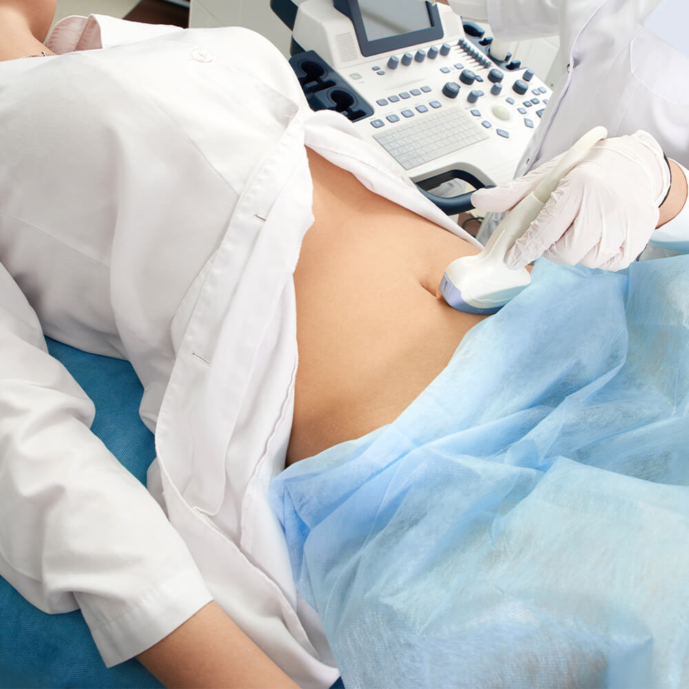 Ultrassom Pélvico Feminino (via abdominal) em João Monlevade