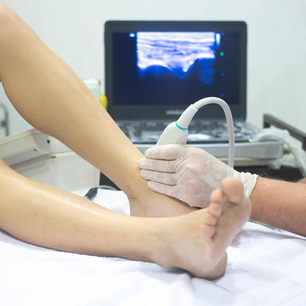 Ultrassonografia de Mão, Pé ou Dedos em João Monlevade