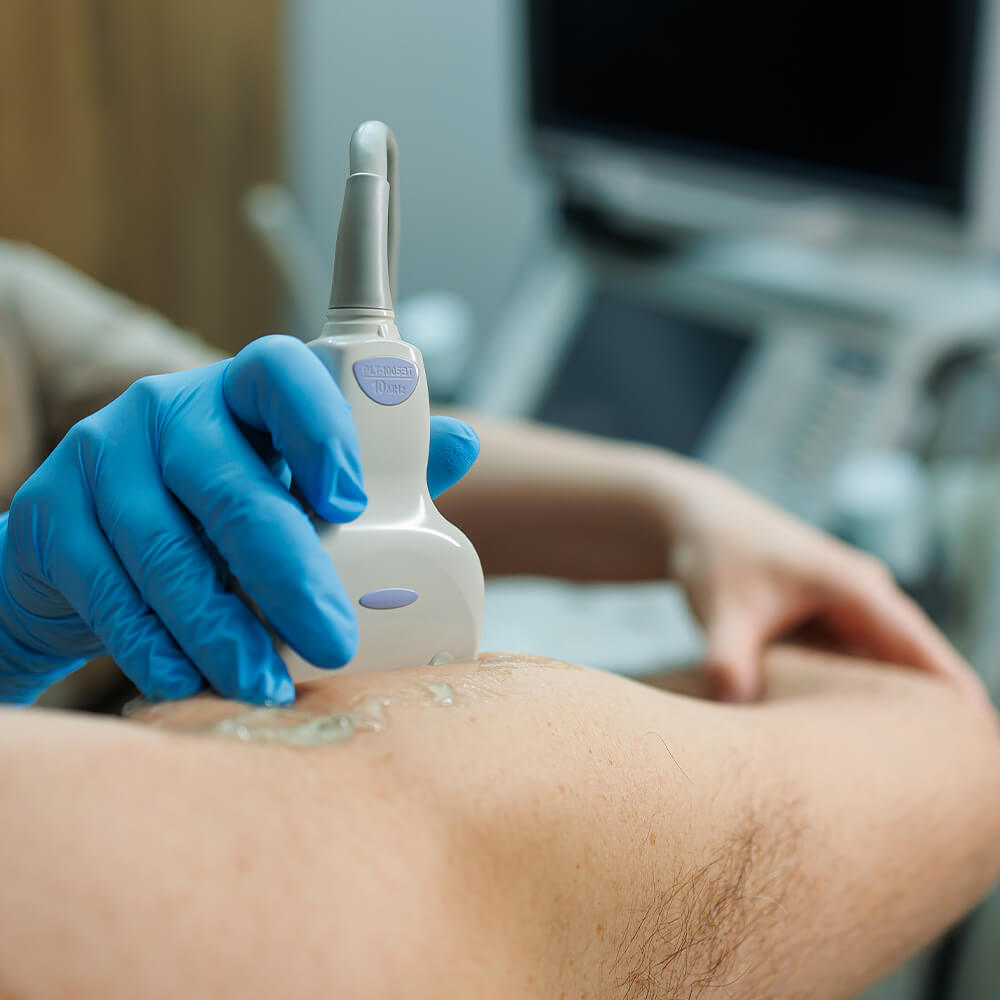 Ultrassonografia Musculoesquelética em João Monlevade